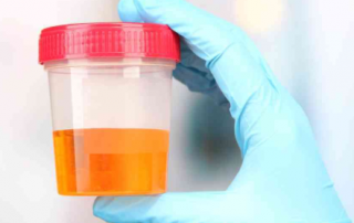 Infections Archives - Healtreatcure